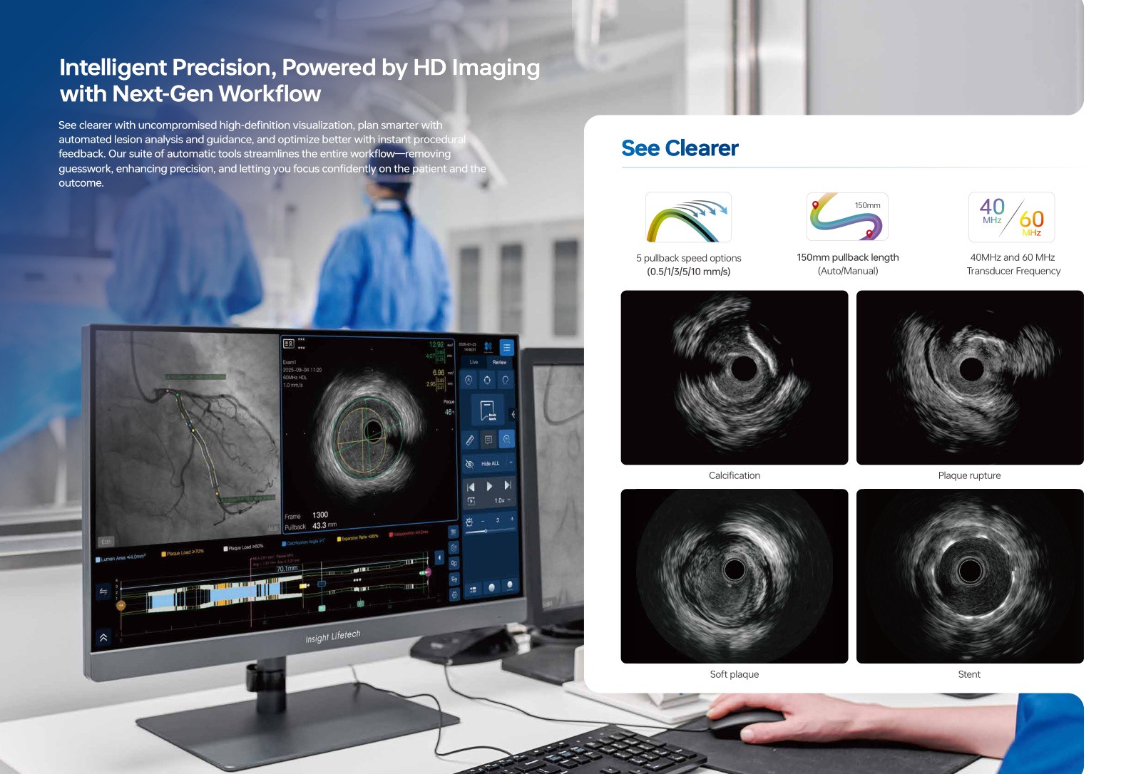 iHeartX IVUS a fyziologie
